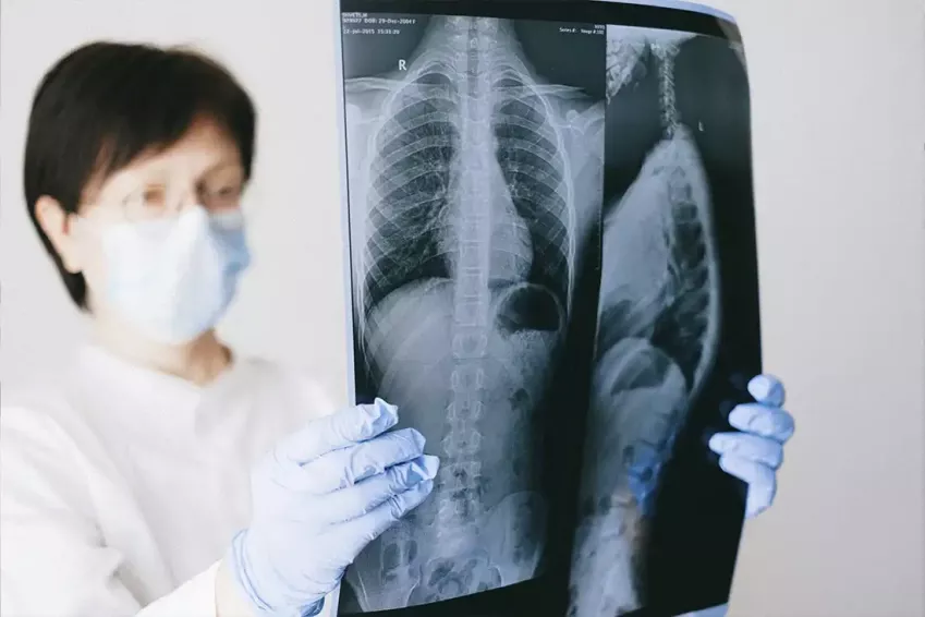 Luchamos contra las enfermedades pulmonares